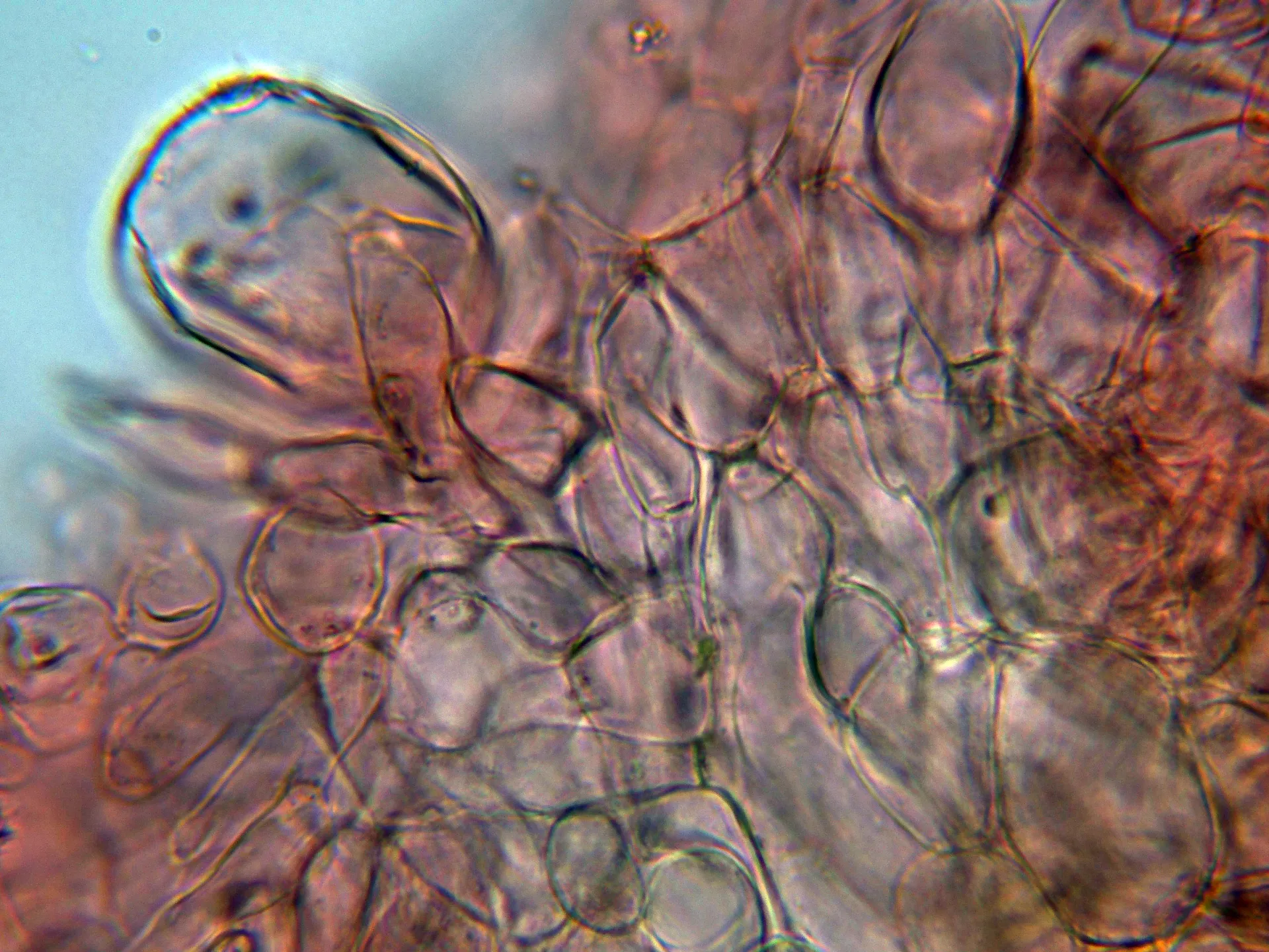 Microscopía de Otidea microspora - 10 - Excípulo ectal-001